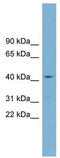 Zinc Finger DHHC-Type Containing 18 antibody, TA329493, Origene, Western Blot image 