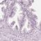 Preferentially Expressed Antigen In Melanoma antibody, HPA045153, Atlas Antibodies, Immunohistochemistry frozen image 
