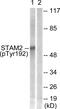 Signal Transducing Adaptor Molecule 2 antibody, PA5-38919, Invitrogen Antibodies, Western Blot image 
