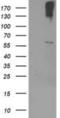 Cytochrome P450 Family 2 Subfamily J Member 2 antibody, NBP2-01286, Novus Biologicals, Western Blot image 