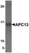 Anaphase Promoting Complex Subunit 13 antibody, NBP1-76261, Novus Biologicals, Western Blot image 