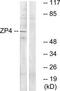 Zona pellucida sperm-binding protein 4 antibody, TA315686, Origene, Western Blot image 