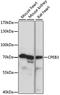 Cytoplasmic polyadenylation element-binding protein 3 antibody, LS-C750372, Lifespan Biosciences, Western Blot image 