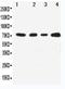 Mitogen-Activated Protein Kinase Kinase Kinase 3 antibody, PA1924, Boster Biological Technology, Western Blot image 