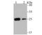 Casein kinase II subunit beta antibody, A03475, Boster Biological Technology, Western Blot image 