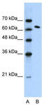 FACT complex subunit SPT16 antibody, TA329319, Origene, Western Blot image 