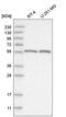 Fanconi anemia group C protein antibody, HPA030771, Atlas Antibodies, Western Blot image 
