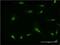 Ribosomal Protein L7 antibody, H00006129-M06, Novus Biologicals, Immunocytochemistry image 