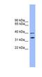 Nedd4 Family Interacting Protein 2 antibody, NBP1-56990, Novus Biologicals, Western Blot image 