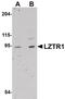 Leucine Zipper Like Transcription Regulator 1 antibody, PA5-20902, Invitrogen Antibodies, Western Blot image 