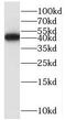 Opioid Related Nociceptin Receptor 1 antibody, FNab05997, FineTest, Western Blot image 