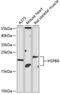 Heat shock protein beta-6 antibody, 15-401, ProSci, Western Blot image 