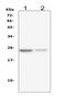 Interleukin 22 antibody, M00963, Boster Biological Technology, Western Blot image 