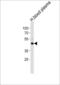 Fibrinogen Gamma Chain antibody, LS-C100912, Lifespan Biosciences, Western Blot image 