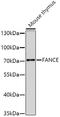 Fanconi anemia group E protein antibody, A07604, Boster Biological Technology, Western Blot image 