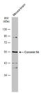Coronin 1A antibody, GTX113931, GeneTex, Western Blot image 