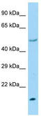Ubiquitin Conjugating Enzyme E2 H antibody, TA329562, Origene, Western Blot image 