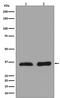 Lactate Dehydrogenase A antibody, M00825, Boster Biological Technology, Western Blot image 