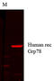 Heat Shock Protein Family A (Hsp70) Member 5 antibody, TA326479, Origene, Immunofluorescence image 