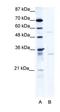 Tripartite Motif Containing 17 antibody, orb324547, Biorbyt, Western Blot image 