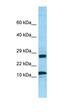 Ribosomal Protein L21 antibody, orb326524, Biorbyt, Western Blot image 
