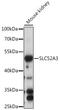 Riboflavin transporter 2 antibody, 16-331, ProSci, Western Blot image 
