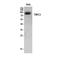 Short transient receptor potential channel 3 antibody, STJ96885, St John