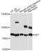 Adenylate Kinase 7 antibody, A09985, Boster Biological Technology, Western Blot image 