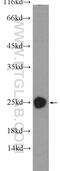 Crystallin Beta B2 antibody, 18154-1-AP, Proteintech Group, Western Blot image 
