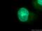 Cyclin Dependent Kinase 4 antibody, 11026-1-AP, Proteintech Group, Immunofluorescence image 