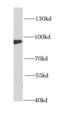 6-phosphofructokinase, muscle type antibody, FNab06341, FineTest, Western Blot image 