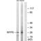 Myogenic Factor 6 antibody, PA5-49794, Invitrogen Antibodies, Western Blot image 
