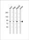 NIMA Related Kinase 10 antibody, PA5-49478, Invitrogen Antibodies, Western Blot image 