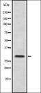 CT47A antibody, orb337633, Biorbyt, Western Blot image 