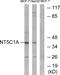 5'-Nucleotidase, Cytosolic IA antibody, A30631, Boster Biological Technology, Western Blot image 