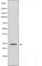 Rho-related GTP-binding protein RhoD antibody, orb226957, Biorbyt, Western Blot image 
