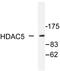Histone deacetylase 5 antibody, AP06393PU-N, Origene, Western Blot image 