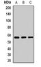 SMU1 DNA Replication Regulator And Spliceosomal Factor antibody, LS-C668789, Lifespan Biosciences, Western Blot image 