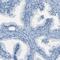 FBN2 antibody, HPA012853, Atlas Antibodies, Immunohistochemistry paraffin image 