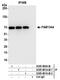 Reticulophagy Regulator Family Member 2 antibody, A305-801A-M, Bethyl Labs, Immunoprecipitation image 