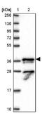 KIAA1191 antibody, PA5-61666, Invitrogen Antibodies, Western Blot image 