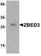 Zinc Finger BED-Type Containing 3 antibody, A14001, Boster Biological Technology, Western Blot image 
