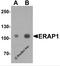 Endoplasmic Reticulum Aminopeptidase 1 antibody, 7467, ProSci Inc, Western Blot image 