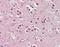 Cholinergic Receptor Nicotinic Beta 2 Subunit antibody, orb96408, Biorbyt, Immunohistochemistry paraffin image 