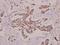 Serine/threonine-protein kinase PRKY antibody, A14965-1, Boster Biological Technology, Immunohistochemistry paraffin image 