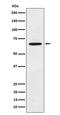 Extracellular Matrix Protein 1 antibody, M02861-1, Boster Biological Technology, Western Blot image 