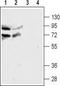 Cholinergic Receptor Nicotinic Alpha 4 Subunit antibody, TA328607, Origene, Western Blot image 