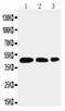 Aquaporin 2 antibody, PA1742, Boster Biological Technology, Western Blot image 
