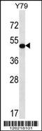 Homeobox protein Hox-A13 antibody, 58-502, ProSci, Western Blot image 