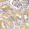 Leucine Zipper Like Transcription Regulator 1 antibody, A7350, ABclonal Technology, Immunohistochemistry paraffin image 
